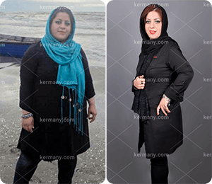 رژیم آنلاین دکتر کرمانی