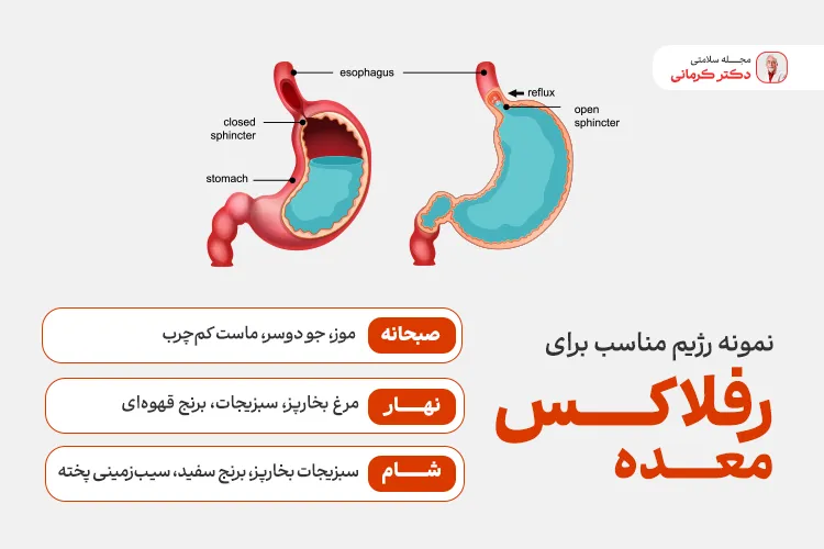 نمونه رژیم مناسب برای رفلاکس