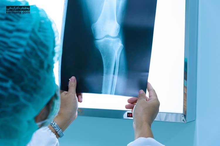 یکی از راه‌های تشخیص آرتریت روماتوئید، عکس‌برداری با اشعه ایکس است.