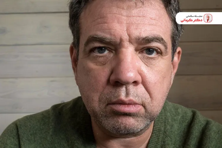 عوامل متعددی در ایجاد پف صورت نقش دارند از جمله مصرف زیاد کافئین.