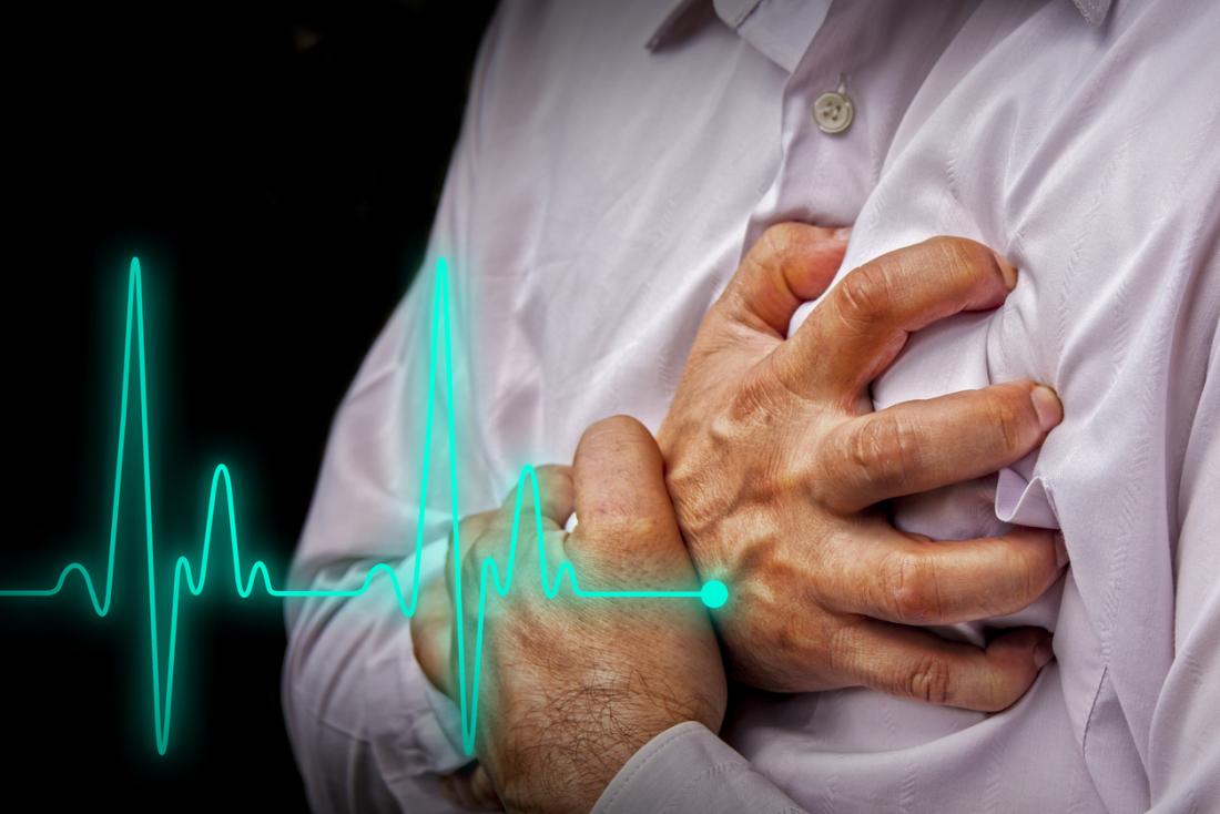 چیزهایی که هر کسی باید درباره سکته قلبی بداند - 5 - سکته قلبی - بیماری
