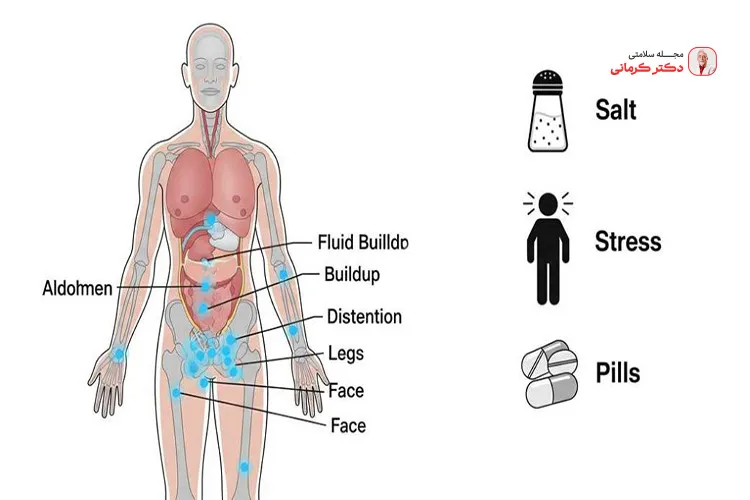 اثر احتباس آب بدن بر وزن! fluid retention 3 مصرف نمک زیاد باعث احتباس آب در بدن میشود.