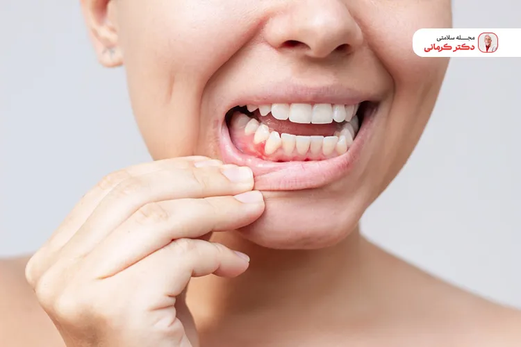 غذاهای مفید برای عفونت دندان درمان قطعی نیستند و شما باید حتما به پزشک مراجعه کنید.