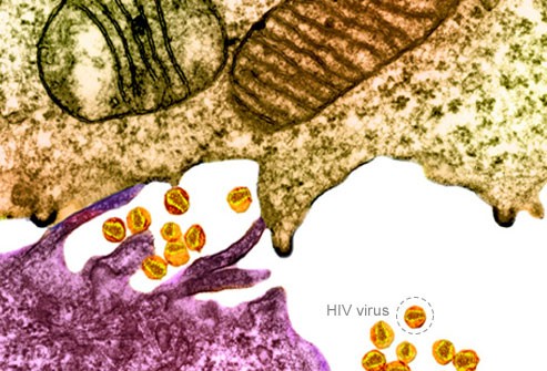 ویروس نقص ایمنی انسانی ( HIV )