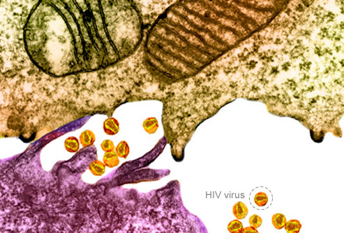 ویروس نقص ایمنی انسان ( HIV )