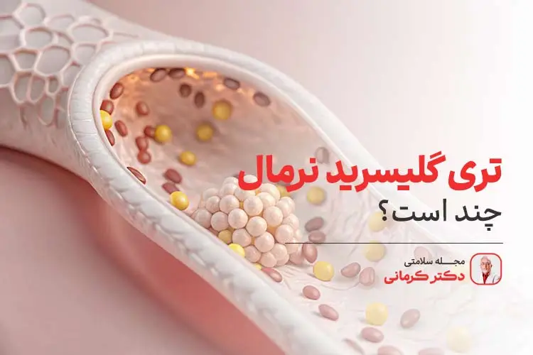 تری گلیسیرید نرمال چند است؟