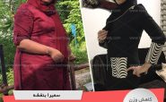 رکورددار کاهش وزن رژیم دکتر کرمانی