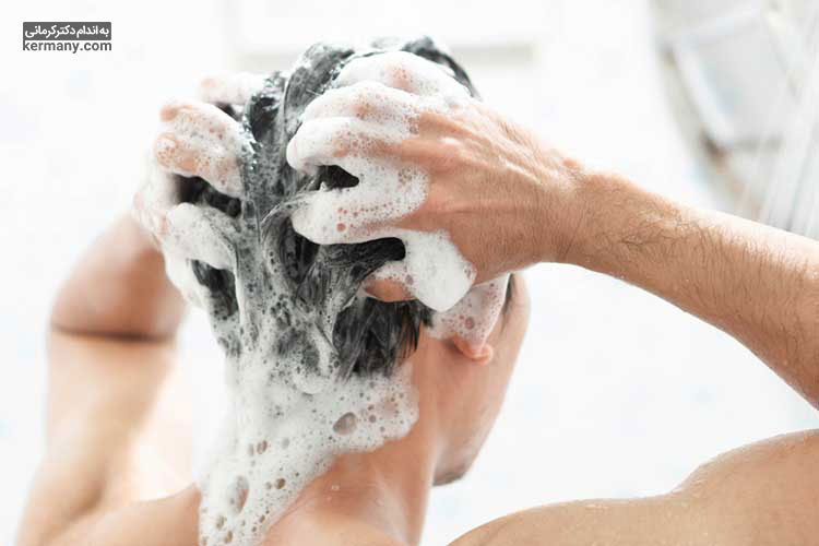 شستشوی بیش از حد موها با شامپوهای دارای سولفات یکی از دلایل ریزش مو است.