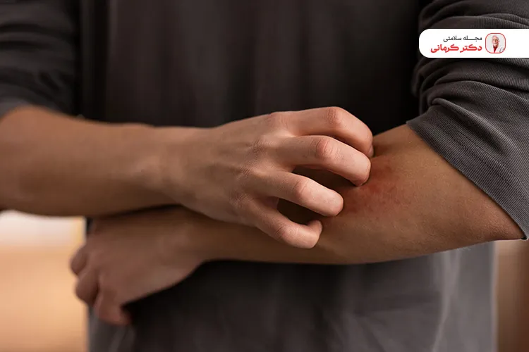 علائم بیماری روی دست