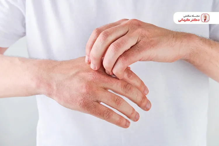 آلرژی به برخی میوه ها در برخی افراد علاوه بر خارش پوست منجر به تنگی نفس و افت فشار خون می‌شود.