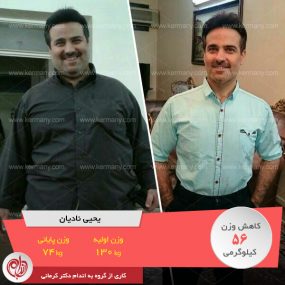 رکورددار کاهش وزن رژیم لاغری دکتر کرمانی کاهش وزن