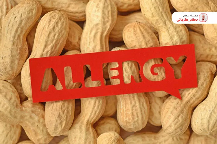 برخی افراد به روغن بادام زمینی حساسیت دارند.