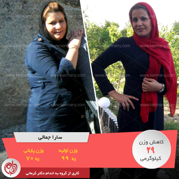 مقاله معجزه دکتر کرمانی را باور کنید رکورددار کاهش وزن رژیم دکتر کرمانی