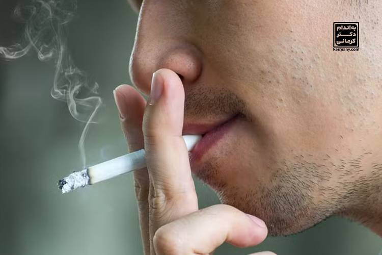 تشدید رفلاکس با سیگار