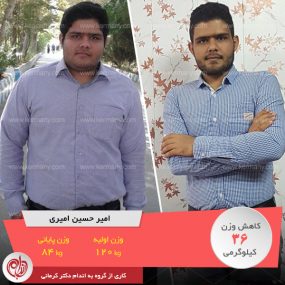 به دکتر کرمانی اعتماد کنید رکورددار رژیم لاغری