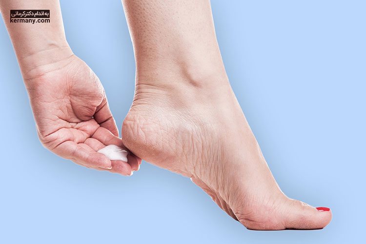 اسکراب کف پای خشک و ضخیم یکی از راه‌های درمان آن است.