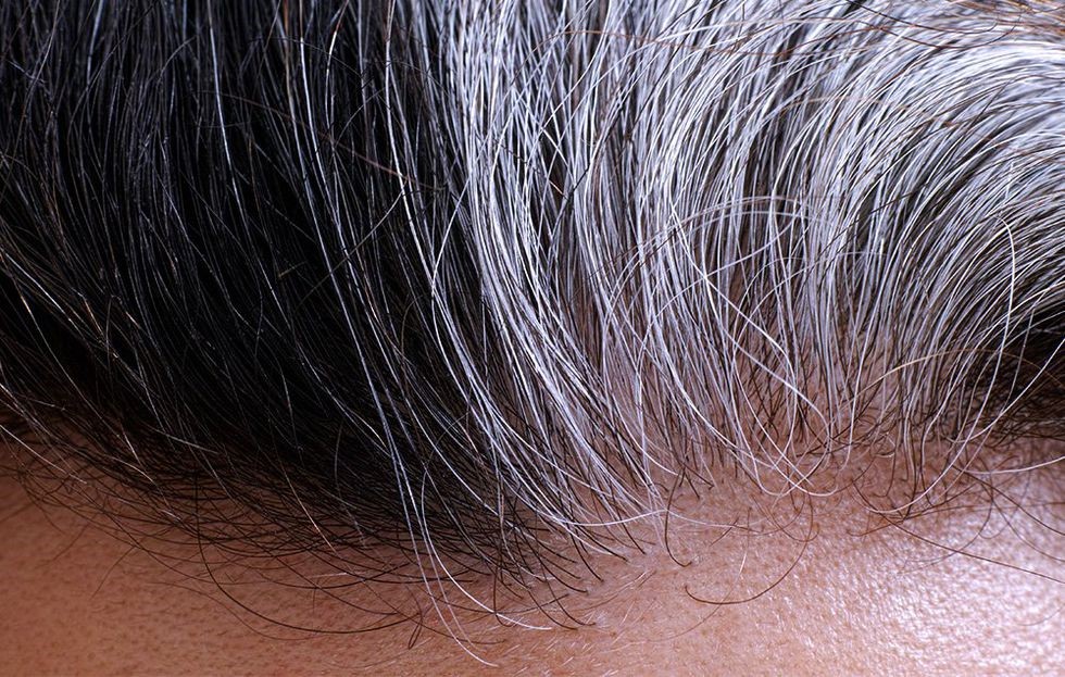 ریزش مو در مردان ؛ دلایل و درمان ریزش مو - 62 - ریزش مو در مردان - ورزش و سلامتی