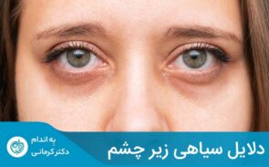 خستگی مفرط و کمبود خواب، می‌تواند یکی از علل ایجاد حلقه‌های سیاه زیر چشم شود.