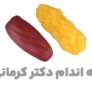 عضله و چربی