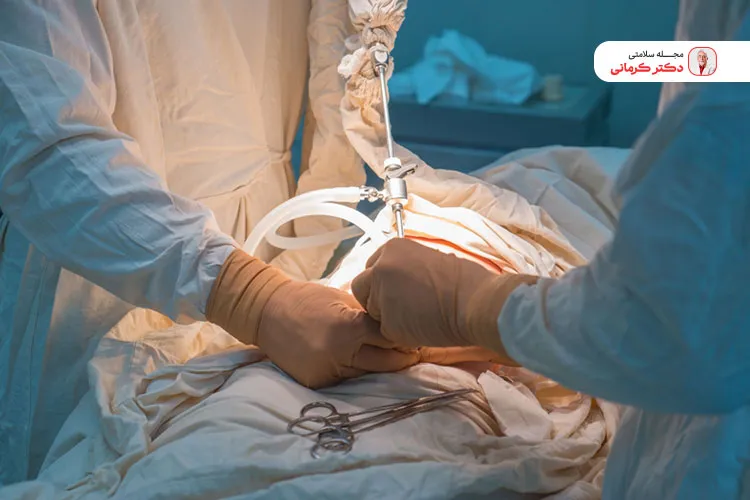 خونریزی شدید ممکن است یکی از عوارض بای پس معده باشد.