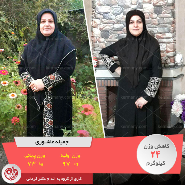 رژیم لاغری دکتر کرمانی برای وزن 97 کیلو