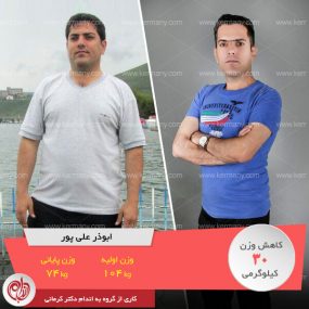 ابوذر علیپور- رکورددار کاهش وزن دکتر کرمانی