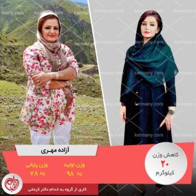 آزاده مهری- رکورددار کاهش وزن دکتر کرمانی