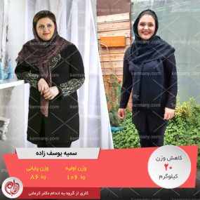 سمیه یوسف زاده - رکورددار کاهش وزن دکتر کرمانی