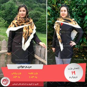 مریم جوادی - رکورددار کاهش وزن دکتر کرمانی
