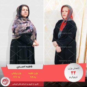 فاطمه احمدی - قهرمان کاهش وزن رژیم آنلاین دکتر کرمانی