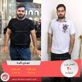 مهدی تکیه - قهرمان کاهش وزن رژیم دکتر کرمانی