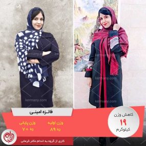 فائزه امینی - قهرمان کاهش وزن رژیم آنلاین دکتر کرمانی