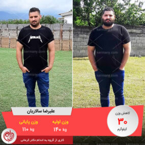 رکورددار کاهش وزن دکتر کرمانی