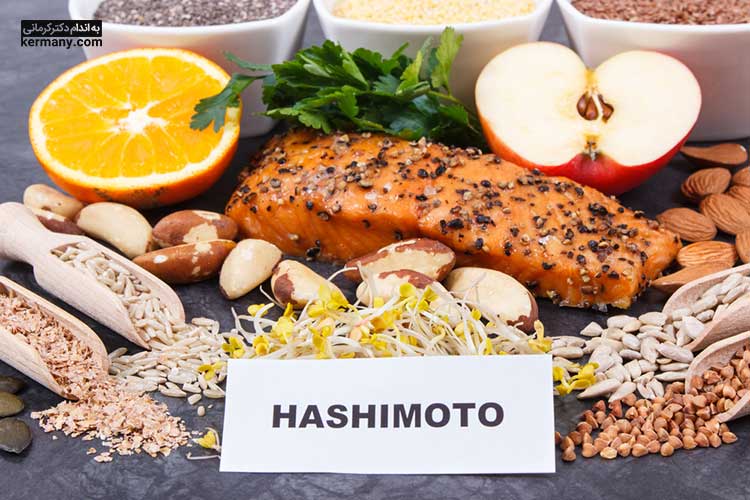 کاهش وزن در بیماران هاشیموتو با کمک یک برنامه غذایی استاندارد و پر پروتئین ضروری است.