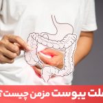 مقاله شایع‌ترین علت یبوست مرتبط با نوع تغذیه افراد است.