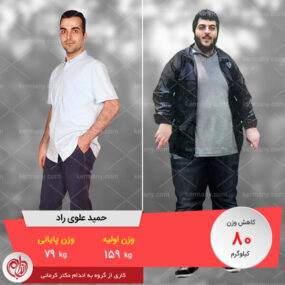 مصاحبه با آقای حمید علوی، رکورددار رژیم لاغری دکتر کرمانی با 80 کیلو کاهش وزن | وزن اولیه: 159 کیلو؛ وزن نهایی: 79 کیلو