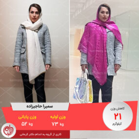 مصاحبه با خانم سمیرا حاجیزاده، رکورددار رژیم لاغری دکتر کرمانی با 21 کیلو کاهش وزن | وزن اولیه: 73 کیلو؛ وزن نهایی: 52 کیلو
