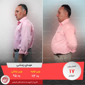 مصاحبه با آقای مهدی زینلی، رکورددار رژیم لاغری دکتر کرمانی با 17 کیلو کاهش وزن | وزن اولیه: 112 کیلو؛ وزن نهایی: 95 کیلو