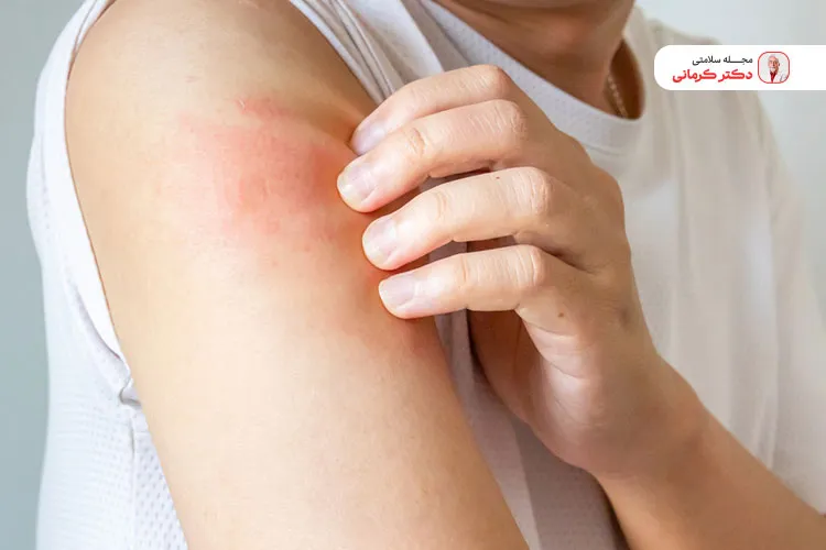 کاهش وزن خطر ابتلا به بیماری‌های دیگر را در افراد مبتلا به پسوریازیس کاهش می‌دهد.