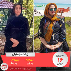 زینت فراستیان رکورددار کاهش وزن دکتر کرمانی وزن اولیه 81 کیلو وزن پایانی 65 کیلو کاهش وزن 16 کیلو