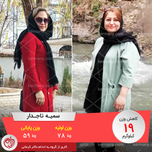 سمیه تاجدار رکورددار کاهش وزن دکتر کرمانی وزن اولیه: 78 وزن پایانی:59 کاهش وزن: 19 کیلو