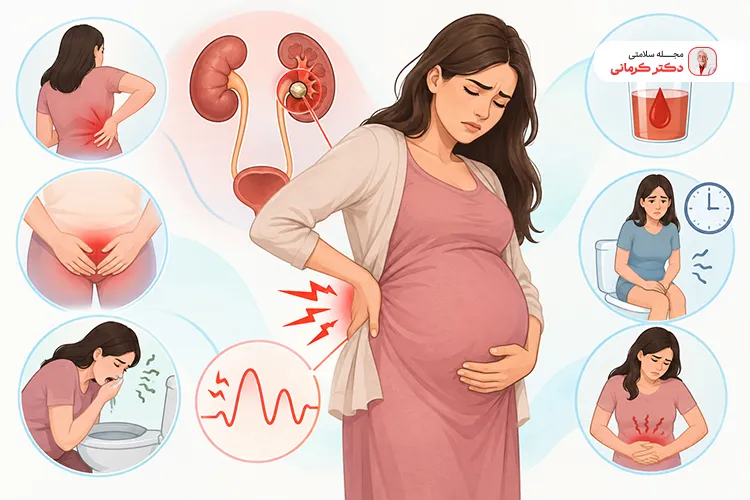 علائم سنگ کلیه در بارداری