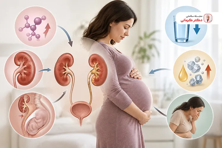 چرا احتمال سنگ کلیه در بارداری ممکن است بیشتر شود؟