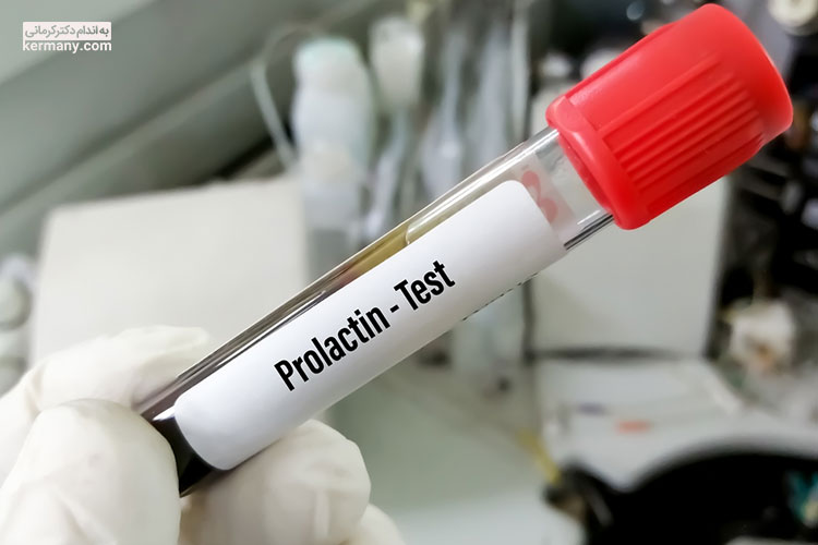  هورمون پرولاکتین با آزمایشی شبیه به آزمایش خون ‌اندازه‌گیری می‌شود.