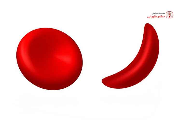 دلایل کم خونی