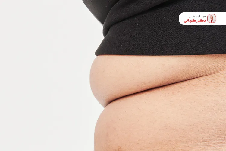 مقصر اصلی چاقی شکم! cause abdominal obesity 2 افزایش سن و تغییرات هورمونی در ایجاد چاقی شکمی بسیار موثر است.