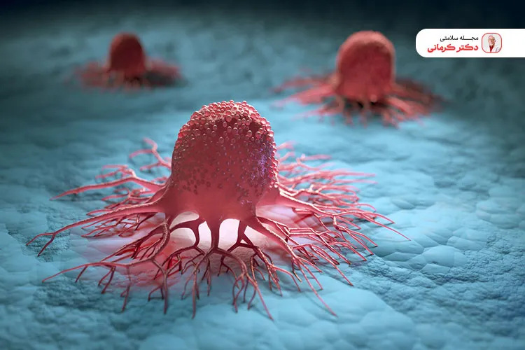 مقصر اصلی چاقی شکم! cause abdominal obesity 9 یکی از عوارض چاقی شکمی ابتلا به انواع سرطان است.