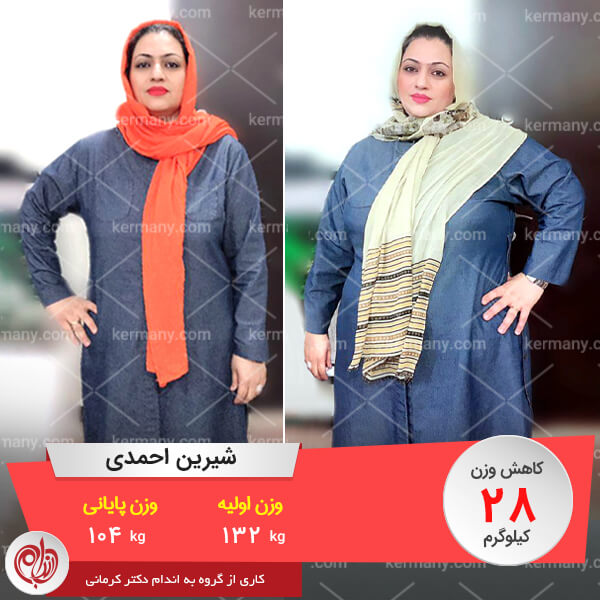 شیرین احمدی رکورددار کاهش وزن دکتر کرمانی وزن اولیه: 132 کیلو وزن پایانی: 104 کیلو کاهش وزن: 28 کیلو