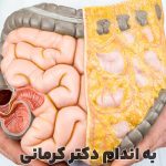 مقاله چربی احشایی چیست؟