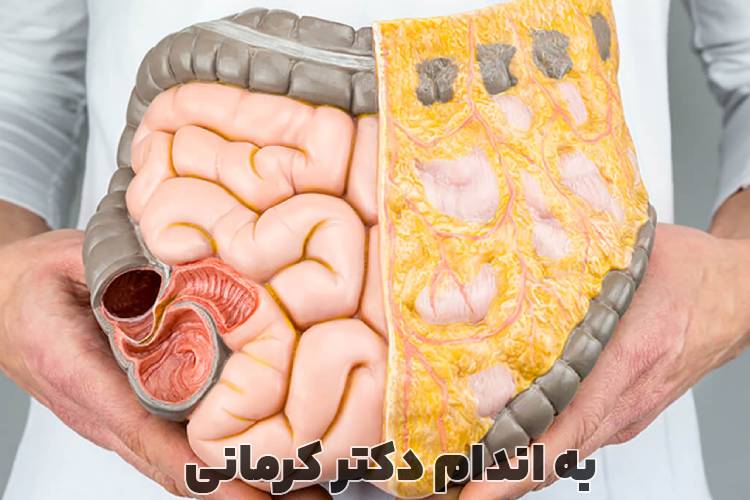 چربی احشایی چیست؟ - - چربی احشایی - تغذیه